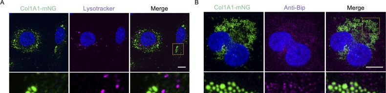 PC1 in condensates is not targeted for degradation. (A) Fluorescence images of LX-2 cells stably expressing Col1A1-mNG (green) stained with LysoTracker Red (magenta) (top), and zoomed inset (bottom) showing that lysosomes are not in the vicinity of PC1 condensates. Scale bar: 10 um; inset: 2 um. (B) Fluorescence images of fixed LX-2 cells stably expressing Col1A1-mNG (green) and stained using antibodies against the chaperone BiP (magenta) (top), and zoomed inset (bottom) showing BiP is excluded from PC1 condensates. Scale bar: 10 um; inset: 2 um.