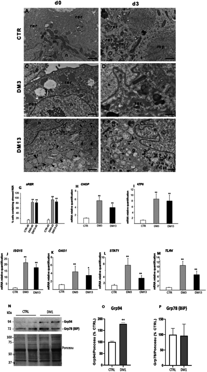 Representative TEM images of RER in myoblasts of CTR (A, B), DM3 (C, D) and DM13 (E, F) after 0-3 days in differentiation medium. Control cells show well-structured parallel RER cisternae (A, B) while DM1 samples display an enlarged stressed rough endoplasmic reticulum (arrowheads) (C, D, E, F). m, mitochondrion; my, myofibrils; n, nucleus; rer, rough endoplasmic reticulum. Scale bars: A, B, C, D, F, 1 um; E, 2 um. The percentage of myoblasts with altered RER cisternae was significantly increased at day 3 in DM3 and DM13 compared to CTR.