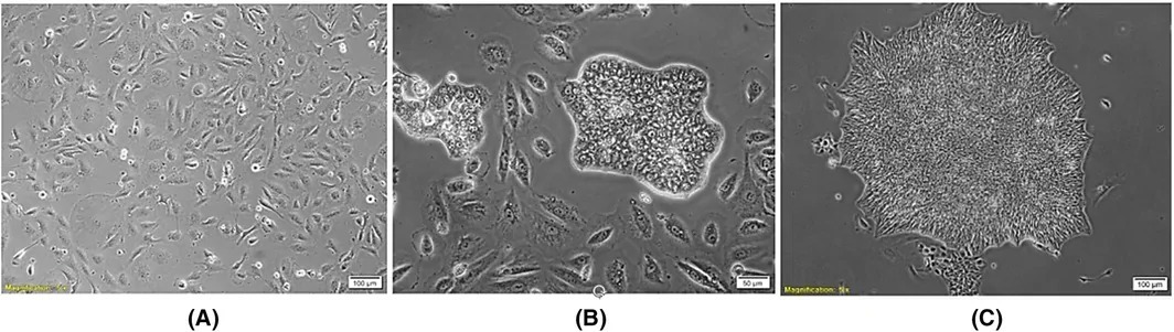 Morphology of Urine-Derived iPSC Colonies. (A) Urine-derived stem cells (USCs) at passage 3 (p3) before Sendai virus (SeV) transfection, serving as a control. Scale bar: 100 µm. (B) Early u-iPSC aggregates on Day 5 after SeV transfection. Scale bar: 500 µm. (C) u-iPSC colony at passage 9 (p9) Day 3. Scale bar: 100 µm. (human (urine-derived induced pluripotent stem cells); Fig. 3, full figure (panels A-C; urine-derived iPSC colony morphology progression).)