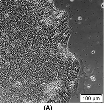 (A) Phase contrast of u-iPSC at p6. All images taken at magnification 5x. Scale bar: 100 µm. (human (urine-derived iPSC at passage 6); Fig. 4, A (phase contrast only; cols 3-351 of figure).)