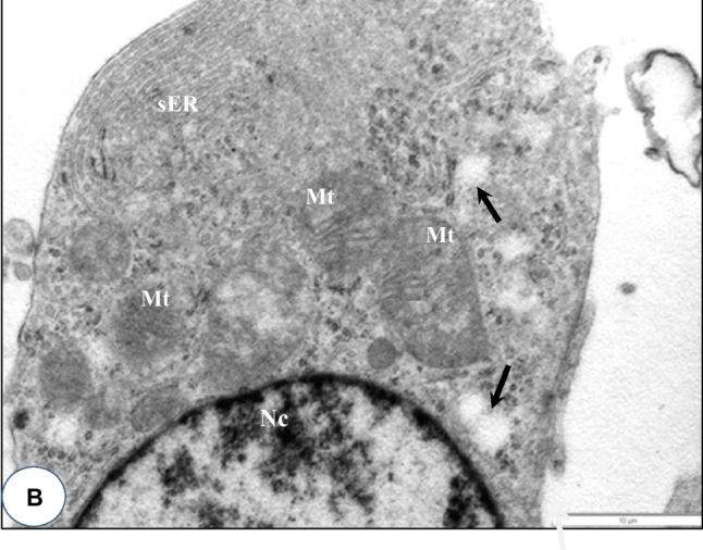A and B Transmission electron micrograph of the testis of DBP-(0 mg/kg) control or low doses DBP (1, 10 mg/kg) showing parts of seminiferous tubules and normal Leydig cells (LC) seen in the Interstitium. Seminiferous epithelium (SE), blood vessel (Bv), myofibroblast (Mc), boundary tissue (arrow heads). B High power view of part of a normal Leydig cell showing numerous mitochondria (Mt), abundant smooth endoplasmic reticulum (sER), a few lipid droplets (black arrows) and a mildly heterochromatic nucleus (Nc) Bar in Fig. 2A (5 um), Bar in Fig. 2B (10 um) (Japanese quail (Coturnix japonica, testicular Leydig cell); Figure 2B (normal Leydig cell, high power view).)