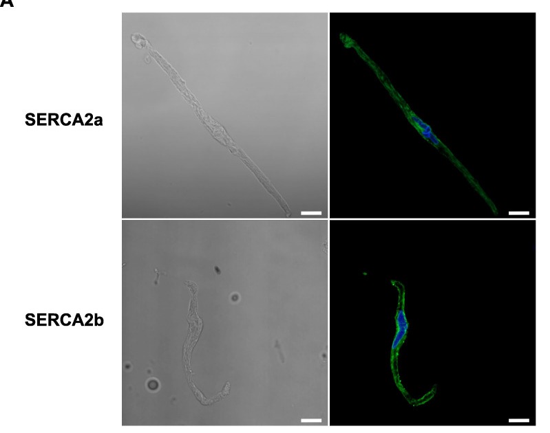Differential subcellular distribution of SERCA2a and SERCA2b in isolated rat MASMC. (A) Representative transmittance images (left) and corresponding fluorescence immunostainings (right) for SERCA2a (top) and SERCA2b (bottom) isoforms, visualized by confocal microscopy. Isolated rat MASMCs were immunostained with isoform-specific antibodies (SERCA2a or SERCA2b) and detected using Alexa Fluor 488-conjugated goat anti-rabbit IgG (green). Fluorescence intensity was subdivided into three distinct subcellular regions and quantified as described in Material and Methods. Nuclei were stained with DAPI (blue). Scale bar = 10 um. Adapted: IF panel A only; scatterplot panels B and C excluded. (rat (mesenteric artery smooth muscle cells); Figure 3, panel A only (confocal transmittance and IF for SERCA2a and SERCA2b; scatterplot panels B and C excluded; rows 10-640 of full figure, 799x630).)