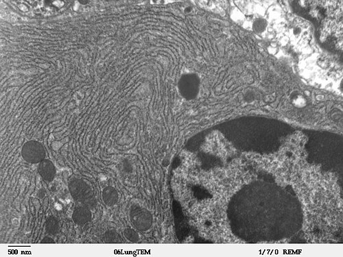Densely packed smooth membranes filling most of a club cell (Clara cell) in lung, with the nucleus and its nucleolus at lower right and a 500 nm scale bar. The club cell is identified by the source, and it is the cell type known for abundant smooth ER. At this magnification the absence of ribosomes on these membranes cannot be confirmed by eye, so the identification rests on the source and on the cell type, not on what is countable in the frame.