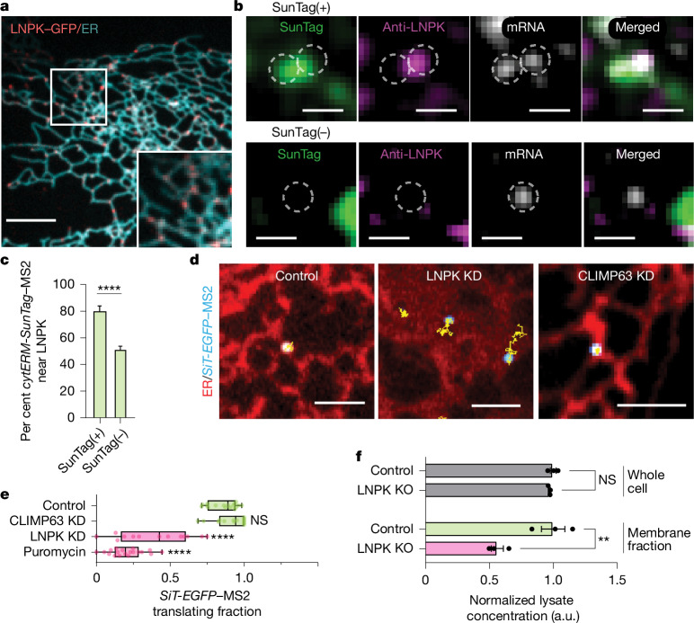 LNPK marks ER junctions that enhance secretome mRNA translation. a, Representative image of LNPK-GFP and ER (Halo-Sec61b, cyan). Inset, enlarged view. Scale bar, 5 um. b, Top, translating SunTag(+) cytERM-SunTag-MS2 (grey) with overlapping SunTag (green) and LNPK (magenta). Bottom, non-translating SunTag(-) cytERM-SunTag-MS2, showing no colocalization with LNPK. Scale bars, 1 um.