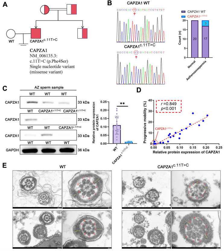 CAPZA1 mutation leads to protein deficiency and impairs sperm progressive motility and flagellar ultrastructure. (A) Pedigree analysis was performed using whole-exome sequencing in an infertile family. Red-filled squares indicate infertile males, with the nucleotide variant information shown below the pedigree. (B) Sanger sequencing chromatograms show wild-type (WT) and mutant (c.11T>C) sequences, with the mutation site highlighted by red boxes and indicated by red arrows. The bar graph represents the number of individuals carrying the WT or CAPZA1 c.11T>C in normal ( n = 20) and asthenozoospermic ( n = 20) groups. (C) Western blot analysis of CAPZA1 expression in non-mutant asthenozoospermic patients (WT) ( n = 17) and mutant asthenozoospermic patients (CAPZA1 c.11T>C) ( n = 3). (D) Spearman correlation between CAPZA1 protein levels and progressive motility. (E) Transmission electron microscopy images of sperm flagella in WT and CAPZA1 c.11T>C sperm. The red numbers denote nine peripheral microtubule doublets, the yellow dash represents longitudinal columns. Scale bars = 500 nm, enlarged = 200 nm. Data are presented as mean +/- SD ( n = 3). ** p < 0.01 compared with WT group. (human (sperm from non-mutant and CAPZA1 c.11T>C asthenozoospermic patients); Figure 1.)