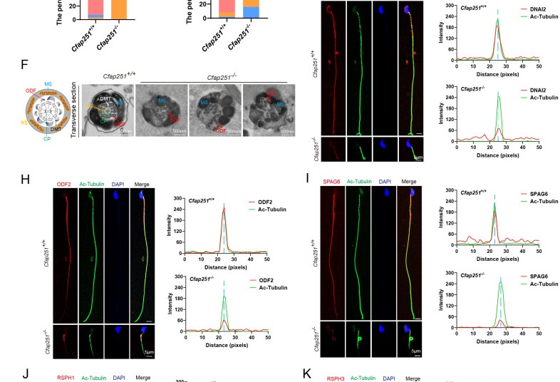 Structural and molecular defects of the sperm flagellum in Cfap251 knockout mice. (B, C) Immunofluorescence of sperm stained with TOMM20 (B, red) or SEPT4 (C, red), acetylated tubulin (green), and DAPI (blue), indicating mitochondrial and annulus defects in Cfap251-/- sperm. Scale bar, 5 um. Adapted: IF panels B and C only; TEM panels A and F, quantification panels D and E, and additional IF panels G-K excluded. (mouse (Cfap251 knockout and wild-type epididymal sperm); Figure 4, panels B and C (IF of mature sperm with TOMM20 and SEPT4; TEM panel A, quantification D-E, and IF G-K excluded).)