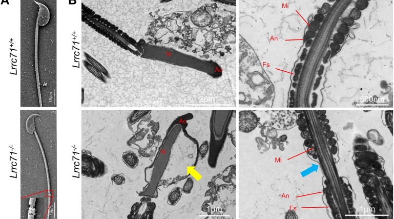 Ultrastructure of sperm from Lrrc71-/- mice. A, scanning electron microscopy (SEM) analysis of epididymal sperm from Lrrc71+/+ and Lrrc71-/- mice. Adapted: SEM panel A only; TEM panels B and C, IF panel D, and quantification panels E and F excluded. (mouse (epididymal sperm, Lrrc71-/- and wild-type); Figure 3, panel A only (SEM of epididymal sperm; TEM panels B-C, IF panel D, and bar charts E-F excluded).)