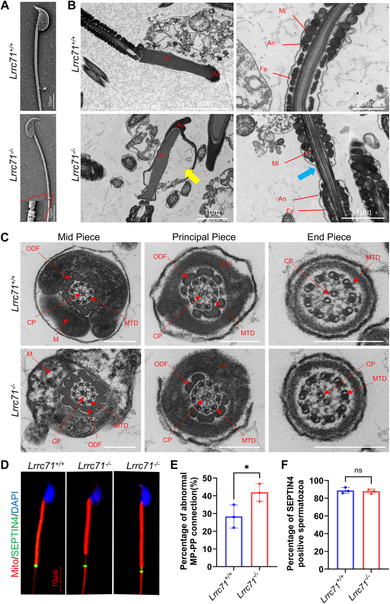 Ultrastructure of sperm from Lrrc71-/- mice. A, scanning electron microscopy (SEM) analysis of epididymal sperm from Lrrc71+/+ and Lrrc71-/- mice. B, transmission electron microscopy (TEM) analysis of epididymal sperm from Lrrc71+/+ and Lrrc71-/- mice. The yellow arrow indicates the detached acrosome from the nuclear membrane, the blue arrow indicates the partial absence of the mitochondrial sheath at the junction between the midpiece and principal piece of the sperm tail. Ac, acrosome; An, annulus; Fs, fiber sheath; Mi, mitochondrion; N, nucleus. C, representative TEM images of sperm cross sections from Lrrc71+/+ and Lrrc71-/- mice. CP, central microtubule; Fs, fiber sheath; M, mitochondrion; MTD, microtubule doublets; ODF, outer dense fiber. Scale bar is 200 nm. D, immunofluorescence (IF) staining was performed to visualize mitochondrial sheath (red color), SEPTIN4 protein expression (green color), and nuclei (blue color) in spermatozoa from Lrrc71+/+ and Lrrc71-/- mice. Scale bar is 10 um. E, percentage of sperm with abnormal midpiece-principal piece connections in Lrrc71+/+ and Lrrc71-/- mice. At least 200 sperm per mouse were counted (n = 3). F, percentage of SEPTIN4-positive sperm in Lrrc71+/+ and Lrrc71-/- mice. At least 200 sperm per mouse were counted (n = 3). All data are presented as mean +/- SD. (mouse (Lrrc71+/+ wild-type and Lrrc71-/- knockout mouse epididymal spermatozoa); Figure 3.)
