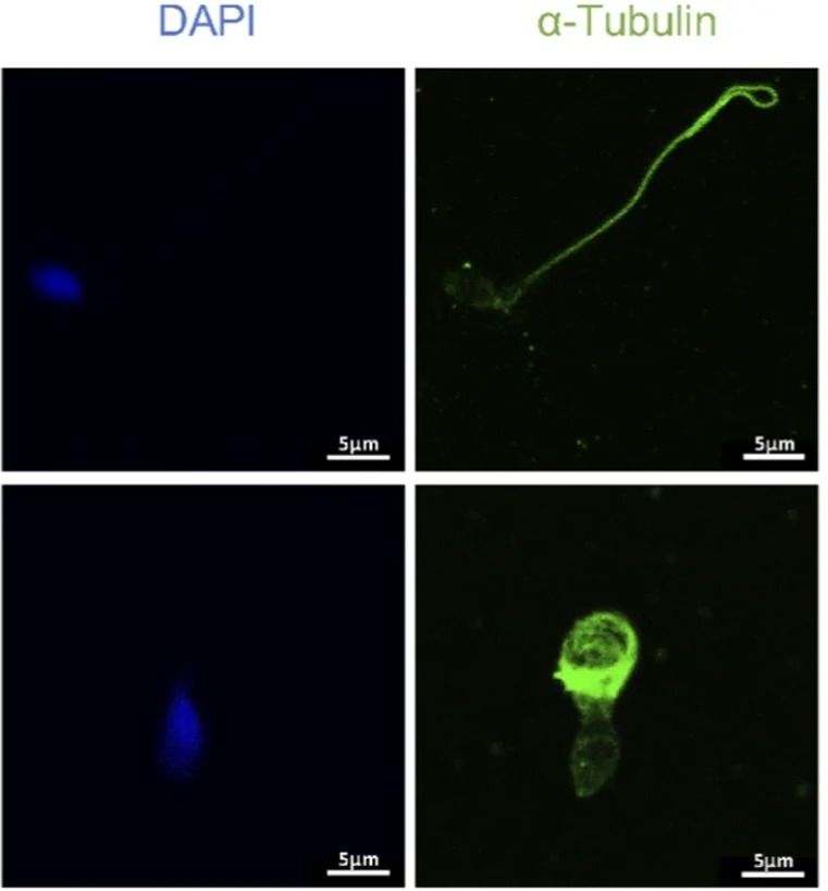 Representative immunofluorescence images of TTC29 in spermatozoa from the fertile control. TTC29 signal was readily detected along the sperm flagellum. alpha-Tubulin labeled the sperm flagellum, and DAPI stained the nuclei. (human (fertile control spermatozoa); FIGURE 4, control arm (fertile control spermatozoa; left half, cols 84-845 of figure).)