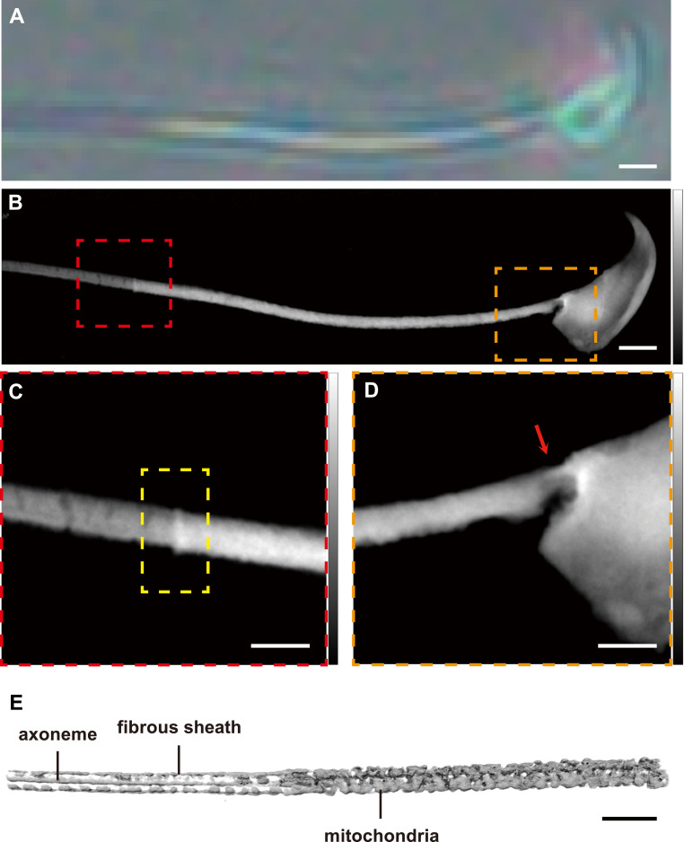 Correlative optical and soft X-ray imaging of a normal mouse spermatozoon. (A) Bright-field optical micrograph of a single sperm cell. (B) Ptychographic soft X-ray phase map of the same cell. (B, C, D) Enlarged views of the boxed regions in panel (B); in (C), the annulus region is outlined by a yellow dashed rectangle; and in (D), the head-midpiece junction is indicated by a red arrow. (E) Cryogenic soft X-ray transmission computed tomography reconstruction of a sperm flagellum, with the axoneme, fibrous sheath, and mitochondrial sheath discernible. Scale bars: (A, B) 2 um; (C, E) 1 um. (mouse (normal mouse spermatozoon); Figure 2..)