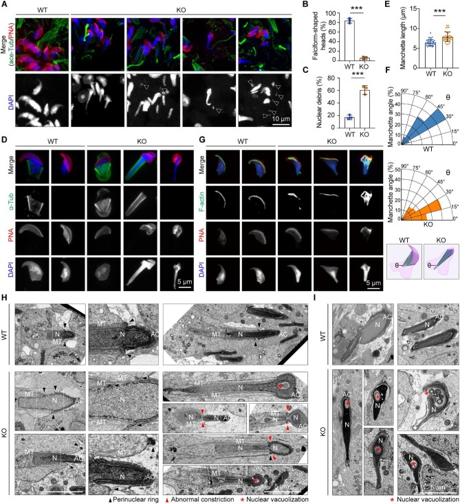 CCDC92 regulates the manchette for the sperm head shaping. (A) Immunofluorescence staining of WT and Ccdc92 KO testis sections with the ace-Tub antibody, Alexa Fluor 568-conjugated PNA, and DAPI. The arrowheads indicate small nuclear debris. (B and C) Quantifications of the falciform-shaped heads (B) and nuclear debris (C) in WT and Ccdc92 KO seminiferous tubules (n = 3 mice per genotype). (D-F) Testicular spermatids were isolated from the WT and Ccdc92 KO testes. (D) Immunofluorescence staining with DAPI, Alexa Fluor 568-conjugated PNA, and the alpha-Tub antibody. (E and F) Quantifications of the manchette length and quarter circular polar plots of the manchette angle (theta) representing the manchette defects. The schematic diagrams illustrate the manchette angles in WT and Ccdc92 KO spermatids. (G) Fluorescence staining of WT and Ccdc92 KO testicular spermatids with DAPI, Alexa Fluor 568-conjugated PNA, and FITC-conjugated phalloidin (F-actin). (H and I) TEM images of the heads of elongating (H) and elongated (I) spermatids in WT and Ccdc92 KO seminiferous tubules. Magnified images of the dashed boxed regions are shown on the right. Note that the anchoring of the acrosome (AC) to the nucleus (N) in elongating Ccdc92 KO spermatids appears unaltered, whereas manchette microtubules (MT) are unconventionally over-elongated. Data are presented as mean +/- SD. Unpaired two-tailed t-test was performed. ***P < 0.001. (Figure 4.)
