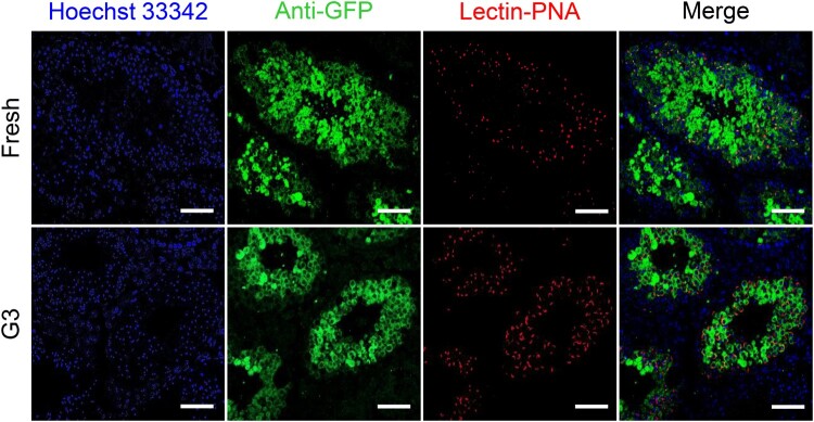 CD71High (G3) cells reconstitute donor-derived spermatogenesis in transplanted testes. Representative fluorescence immunohistochemistry images show germ cell colonies derived from CD71high (G3) cells, similar to control colonies formed by unsorted fresh cells within recipient seminiferous tubules. Spermatogenic differentiation of both unsorted fresh cells and CD71high (G3) GC-SSCs was confirmed using lectin-peanut agglutinin (PNA) staining. Functional spermatogenic colonies derived from the transplanted cells were observed throughout the seminiferous tubules. Nuclei were counterstained with Hoechst 33342 (blue), and donor-derived germ cells were visualized using GFP expression. Scale bar = 50 um. (mouse (CD71high spermatogonial stem cells transplanted into recipient testes); Figure 5.)