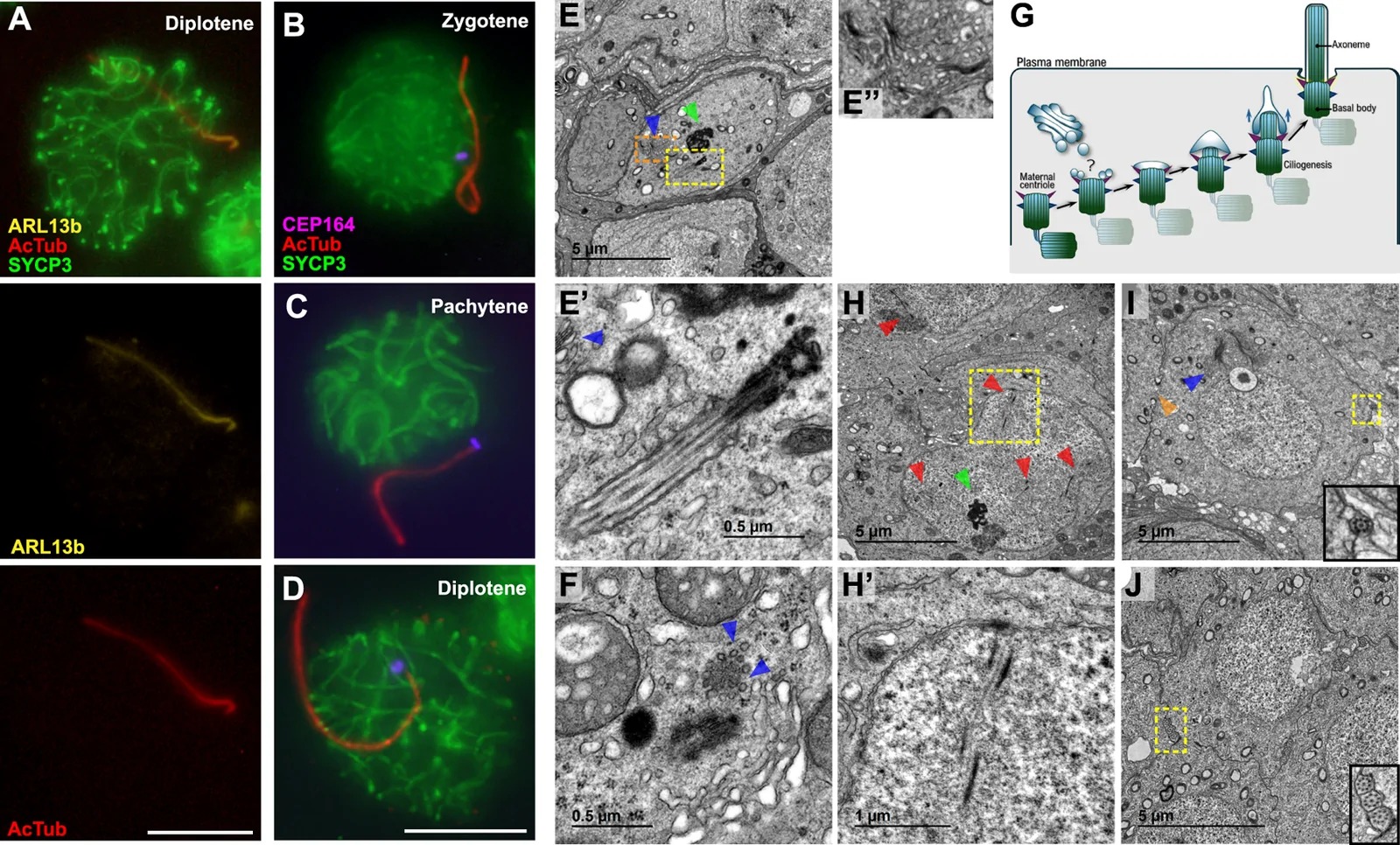 Ultrastructure and markers of prepuberal meiotic cilia. (A) Triple immunolabelling of acetylated Tubulin (AcTub) (red), synaptonemal complex protein 3 (SYCP3) (green) and ARL13b (yellow) in mouse spermatocytes in diplotene stage. (B-D) Triple immunolabelling of acetylated Tubulin (AcTub) (red), synaptonemal complex protein 3 (SYCP3) (green) and CEP164 (magenta) in mouse spermatocytes during prophase I (zygotene, pachytene and diplotene). All images are z-projection of 30-60 frames of stack images of each cell. Scale bars represent 10 um. (E-J) Ultrastructure of axonemes in prepuberal meiosis. (E) Electron microscopy images of a ciliated spermatocyte. Amplified images of the cilia (E') and the Golgi apparatus (E''). (F) Centrosomes with Golgi derived vesicles in the maternal centriole. (G) Schematic representation of intracellular ciliogenesis pathway. (H) Prophase I spermatocyte. Amplified images of synaptonemal complex (H'). (I,J) Mid spermatids presenting preacrosomic vesicle. Enhanced images of the flagella are offered. Blue arrowheads point to Golgi apparatus vesicles. Red arrowheads point to fragments of synaptonemal complex. Green arrowheads point to nucleolus. Orange arrowheads point to intercellular bridge between spermatids. Scale bars are included in each image. (mouse (prepubertal mouse testis spermatocytes at prophase I stages of first spermatogenesis wave); FIGURE 3.)