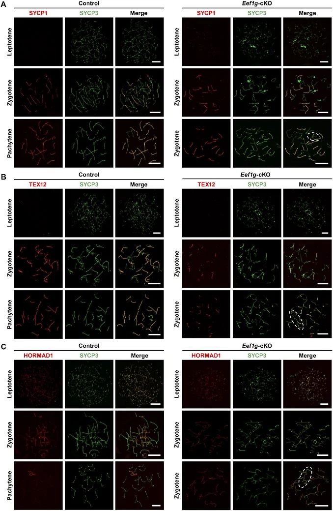 Eef1g-deficient spermatocytes exhibit synaptic defects. (A) Representative spread spermatocytes from 10-week-old control and Eef1g-cKO mice stained with antibodies against SYCP3 (green) and SYCP1 (red). Scale bars, 10 um. The chromosome axes showed that non-homologous synapsis was circled with white dashed lines. (B) Representative images of spermatocyte spreads from 10-week-old control and Eef1g-cKO mice stained for SYCP3 (green) and TEX12 (red). Scale bars, 10 um. The chromosome axes showed non-homologous synapsis were circled with white dashed lines. (C) Representative images of spermatocyte spreads from 10-week-old control and Eef1g-cKO mice stained for SYCP3 (green) and HORMAD1 (red). Scale bars: 10 um. The chromosome axes showed non-homologous synapsis were circled with white dashed lines. (mouse (10-week-old control and Eef1g-cKO mouse spermatocytes); FIGURE 4.)