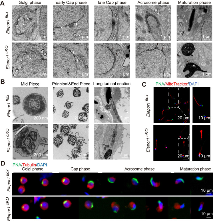 ELAPOR1 is essential for proacrosomal vesicle fusion, mitochondrial organization, and manchette formation. (A) Ultrastructural analysis of developing acrosomes in spermatids at different stages from Elapor1 flox and Elapor1 cKO mouse testes using transmission electron microscopy. Bar = 1 um. White arrows, proacrosomal vesicles; black arrows, pseudoacrosome-like structures. (B) Ultrastructural analysis of Elapor1 flox and Elapor1 cKO spermatozoa in cross sections and longitudinal sections using transmission electron microscopy. Bar = 200 nm for cross sections, and bar = 2 um for longitudinal sections. (C) Mitochondrial organization and acrosome structures of Elapor1 flox and Elapor1 cKO sperm were evaluated using MitoTracker and PNA staining. The nuclei were counterstained with DAPI. Bar = 20 um in the main panels (left panels) and bar = 10 um in the magnified panels (right panels). (D) Spermatids at different stages collected from Elapor1 flox and Elapor1 cKO mice were stained with PNA and alpha-tubulin to observe elongation of the manchette structures. The nuclei were counterstained with DAPI. Bar = 10 um. (Figure 3.)