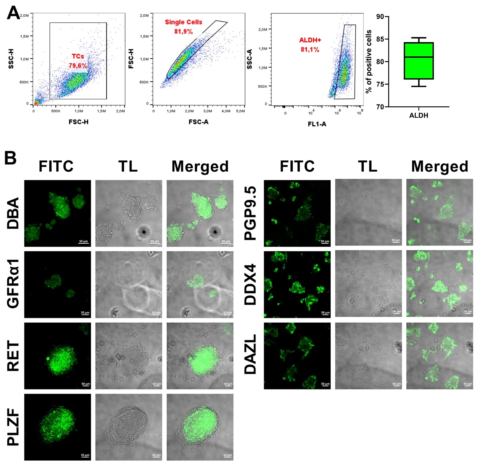 Immunofluorescent analysis of selected potential SSC markers expressed by rabbit SSC co-cultured with somatic testicular cells. representative flow-cytometric dot plots show gating strategy and ALDH analysis using a specific ALDEFLUOR kit (TC - testicular cells). The data from four biological replicates are expressed as the mean +/- SD (A). Rabbit SSC colonies in culture expressing several markers analyzed by laser scanning confocal microscope Zeiss LSM 700 (FITC - green channel, TL - transmitted light; magnification at 200x; scale bar = 50 um) (B). (Figure 4.)