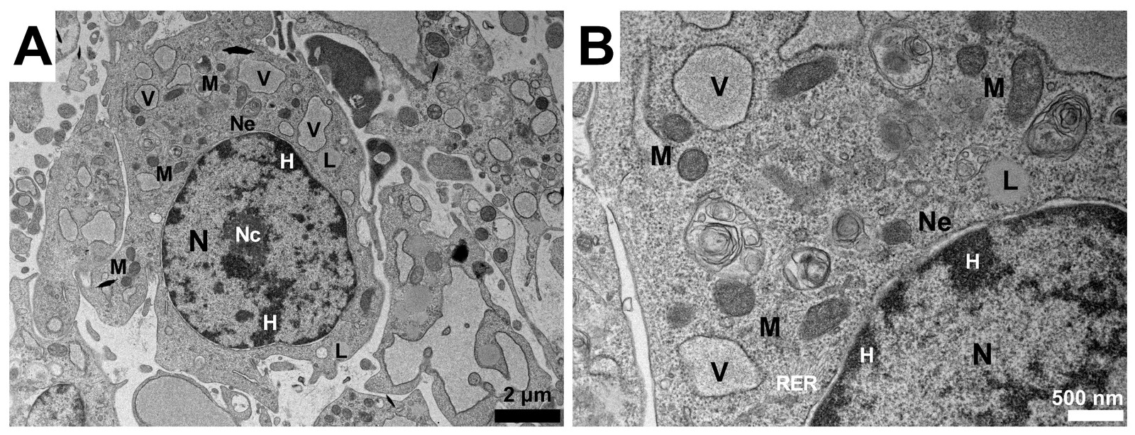 Electron micrographs of cultured rabbit SSCs. TEM micrographs of an entire cell (A) with an oval shape with large round nucleus (N) surrounded by double nuclear envelope (Ne) and containing small nucleolus (Nc) and dense heterochromatin (H), while many round mitochondria (M) and different vacuoles (V), and few lipid droplets (L) and rough endoplasmic reticulum (RER) are present throughout the cytoplasm (B). (Figure 5.)