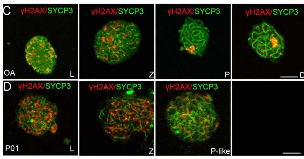 Immunofluorescence staining of meiotic chromosome spreads from an OA control with normal spermatogenesis (C) and patient P01 (D) using antibodies against SYCP3 and γH2AX. SYCP3 is shown in green and γH2AX in red. OA control spermatocytes showed stage-appropriate γH2AX localization, whereas P01 spermatocytes showed persistent nuclear-wide γH2AX staining and absence of a typical γH2AX-positive XY body. L, leptotene; Z, zygotene; P, pachytene; D, diplotene; P-like, pachytene-like. Scale bar, 10 μm. (human; Figure 3, panels C and D.)