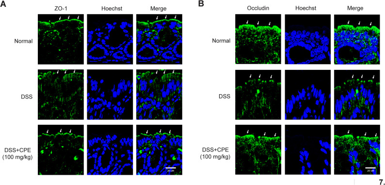 Effects of CPE on tight junction localization of colonic tissues from DSS-induced colitis mice. A Immunofluorescence images of ZO-1 localization. ZO-1 localization at the apical junction region was predominantly disrupted in DSS-induced mice compared to normal and CPE treatment fully recovered its localization. B Immunofluorescence images of occludin localization. In DSS-fed mice, it was found tha