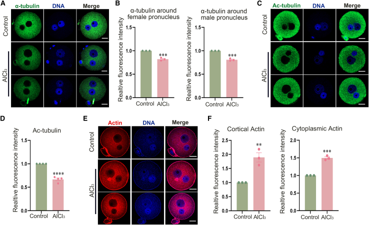 Aluminum exposure disrupts microtubule and actin filament structures in mouse zygotes (A) Typical images of the distribution of alpha-tubulin in control and AlCl3-treated mouse zygotes by immunofluorescence staining. Green, alpha-tubulin; blue, DNA. Scale bars, 20 um. (B) Relative fluorescence intensity of alpha-tubulin around female and male pronuclei. Female pronucleus: Control, n = 42; AlCl3, n = 52, *** p < 0.001; Male pronucleus: control, n = 42; AlCl3, n = 52, *** p < 0.0005. (C) Typical images of Ac-tubulin staining in control and treatment groups by immunofluorescence staining. Green, Ac-tubulin; blue, DNA. Scale bars, 20 um. (D) Relative fluorescence intensity of Ac-tubulin. Control, n = 56; AlCl3, n = 50, **** p < 0.0001. (E) Typical distribution of actin in control and AlCl3-treated mouse zygotes by fluorescence staining. Red, actin; blue, DNA. Scale bars, 20 um. (F) Relative fluorescence intensity of cortical actin and cytoplasmic actin. Cortical actin: control, n = 42; AlCl3, n = 43, ** p < 0.01; cytoplasmic actin: control, n = 41; AlCl3, n = 44, *** p < 0.0005. Data are presented as mean +/- SEM. (mouse (fertilized mouse zygotes; control and AlCl3 aluminum chloride treated groups); Figure 2.)