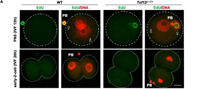 Tcf12-maternal deletion impairs separation of sister chromatids, induced cell cycle delay of zygote. (A) Detection of DNA replication in WT and Tcf12 female-/male+ zygotes after IVF using 5-ethynyl-2'-deoxy-uridine (EdU) incorporation. PB: Polar body. The rates of representative oocytes are shown in the corners. Scale bar, 50 um. Adapted: fluorescence panel A only; quantification panels B-E and H3S10 IF panel F excluded. (mouse (IVF zygotes, WT and Tcf12 maternal-knockout); FIGURE 5, panel A only (EdU fluorescence of zygotes; quantification panels B-E and H3S10 IF panel F excluded).)