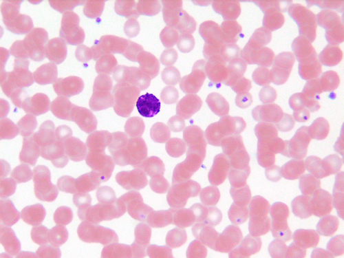 Basophil surrounded by erythrocytes and platelets in a Wright-stained peripheral blood smear.