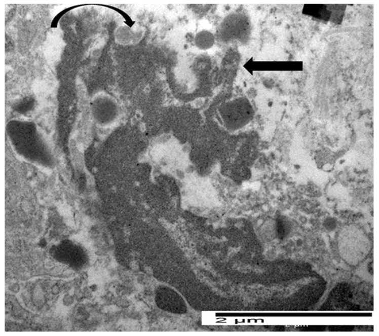 Transmission electron micrograph illustrating an advanced stage of eosinophil ETosis. Extracellular DNA traps appear as decondensed chromatin fibers decorated with granule proteins extending from the cell.