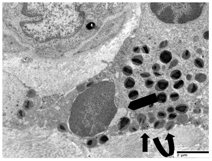 Transmission electron micrograph of an eosinophil showing ultrastructural signs of early ETosis, including a slightly irregular nuclear profile and altered granule distribution.