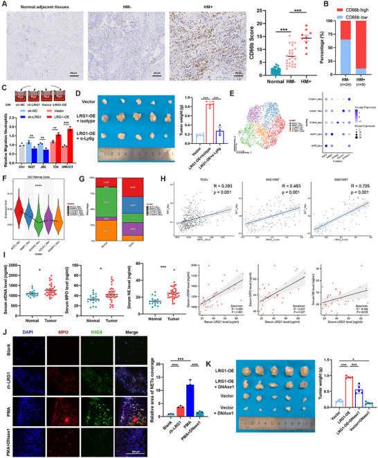 Tumor-derived LRG1 promotes cancer progression by recruiting neutrophils and driving NETosis. (A, B) Representative IHC images and quantification of CD66b+ neutrophil infiltration density in HM+ versus HM- BCa tissues. (C) Transwell assays evaluating the chemotactic effect of tumor-derived LRG1 on isolated human neutrophils. (D) Representative macroscopic images and endpoint tumor weights demonstrating the neutrophil-dependent tumor-promoting effect of LRG1 in vivo, which is effectively rescued by anti-Ly6G antibody depletion. (E) UMAP plot demonstrating the reclustering and annotation of distinct neutrophil subpopulations based on subcluster-specific marker genes from the scRNA-seq cohort. (F) Gene set enrichment scoring of the KEGG NETs pathway across neutrophil subpopulations, highlighting significant enrichment in the NCF2_neu subset. (G) Comparative analysis of the relative proportion of the NCF2_neu subpopulation between normal and BCa tumor tissues. (H) GSVA correlation analysis between the LRG1_tumor meta-program and NCF2_neu infiltration abundance across three independent bulk RNA-seq datasets. (I) ELISA quantification of serum NETs markers (cfDNA, MPO, NE) and their correlation with LRG1 levels. (J) Immunofluorescence staining for MPO and H3Cit in neutrophils directly stimulated with rh-LRG1 or PMA. (K) Representative macroscopic images and endpoint tumor weights demonstrating the rescue of LRG1-induced tumor progression by DNase I treatment in vivo.