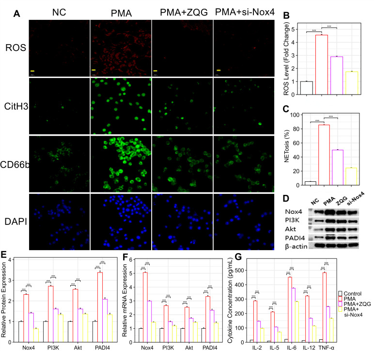 ZQG attenuates PMA-induced NETosis and inflammatory responses in human neutrophils via targeting the Nox4/ROS pathway. (A) ZQG suppresses oxidative burst and NET formation. Representative immunofluorescence images showing intracellular ROS (stained by DHE, red) and NETosis (marked by CitH3, green). Nuclei are counterstained with DAPI (blue). Scale bars: 20 um. (B) Quantitative analysis of intracellular ROS levels. (C) Quantification of NETosis, expressed as the percentage of Sytox Green+ cells. (D) Western blot analysis demonstrating the effects of ZQG and si-Nox4 on the protein expression of Nox4, p-Akt, and PADI4. (E) Densitometric quantification of Western blot results. (F) qPCR analysis of Nox4, PI3K, Akt, and PADI4 mRNA expression. (G) ELISA analysis of pro-inflammatory cytokine levels (IL-2, IL-5, IL-6, IL-12, TNF-alpha) in cell culture supernatants. Data are presented as mean ± SEM (n=10 independent experiments).
