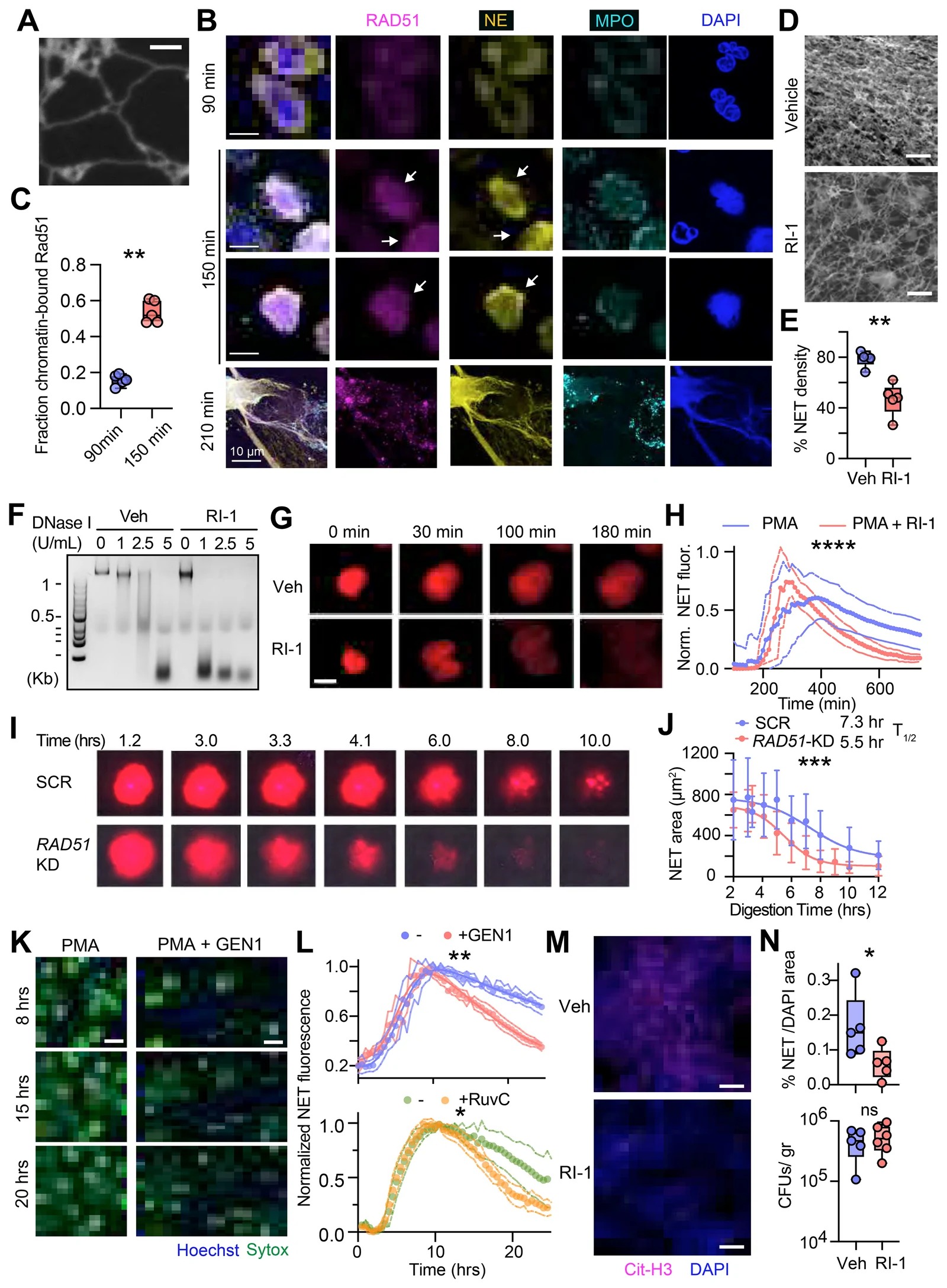 RAD51 cross-links NET chromatin to maintain NET stability. (A) Transmission electron microscopy of NETs formed by human neutrophils isolated from the blood and stimulated with PMA for 4 hrs. (B) Single z-plane micrographs obtained by confocal fluorescence microscopy of human neutrophils activated with PMA at different stages of NETosis, stained for RAD51 (magenta), NE (yellow), MPO (cyan), and DNA (DAPI, blue). Arrows depict RAD51 translocated to the nucleus alongside NE. (C) Quantification of the fraction of RAD51 colocalizing with chromatin (DAPI) in individual human blood neutrophils at 90 min (N=6) and 150 min (N=5) post-PMA stimulation. (D) Electron microscopy of NET chromatin formed by human neutrophils stimulated with PMA in the presence of vehicle (DMSO) or RI-1. (E) Quantification of NET density in multiple electron micrographs as shown in (D). (G) Timelapse microscopy of degradation of NETs formed by human blood neutrophils in 3% human plasma treated with vehicle (DMSO) or RI-1. NETs were stained with Sytox Green and tracked every 5 min for 180 min post-NET formation. Scale bar: 50 um.