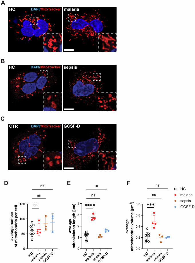 High-resolution confocal microscopy of neutrophils showing mitochondrial morphology differences in malaria-elicited versus sepsis-elicited neutrophils. Mitochondrial dynamics correlate with degranulation capacity.