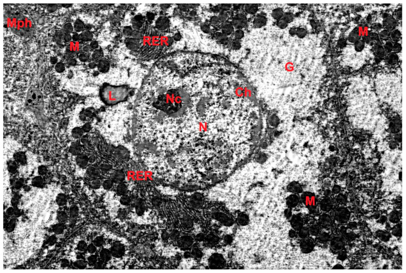 Ultrastructure of hepatocytes of animals of the dark-deprivation group (constant artificial lighting, 3 months). G--glycogen, RER--granular endoplasmic reticulum, L--lipid droplet, M--mitochondria, Mph--macrophage, Ch--chromatin, N--nucleus, Nc--nucleolus. TEM, x5000.
