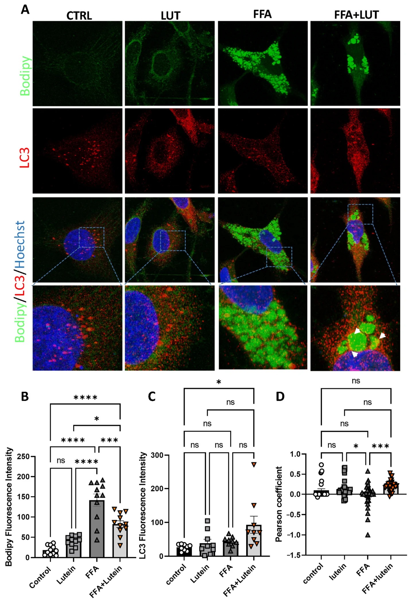 Lutein modulates lipid accumulation and LC3 distribution in an in vitro model of steatosis. HepG2 cells were treated for 12 h with free fatty acids (FFAs) to induce steatosis and/or with lutein (10 uM). (A) Representative immunofluorescence images acquired by confocal microscopy with 3D reconstruction using Airyscan, showing LC3 (red), lipid droplets stained with BODIPY (green), and nuclei stained with Hoechst (blue). White arrows indicate LC3 colocalization with lipid droplets. (B) Quantification of BODIPY fluorescence intensity. (C) Quantification of LC3 fluorescence intensity. (D) Colocalization analysis between LC3 and BODIPY, expressed as Pearson's correlation coefficient, performed using ImageJ. Data are presented as mean +/- SEM of n = 3 independent experiments.