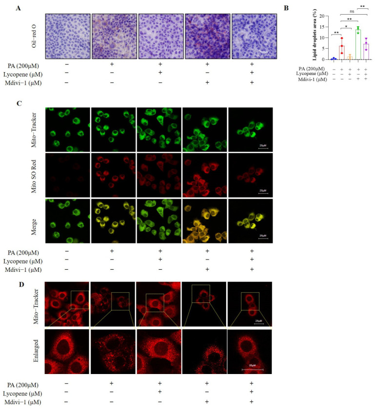 Lycopene alleviate palmitic acid-induced hepatocyte lipotoxicity and mitochondrial dysfunction by improving mitophagy. (A) Oil Red O staining showing lipid accumulation in different groups, 50x. (B) Lipid droplets area of Oil Red O staining. (C) Mitochondria-ROS co-staining revealing oxidative stress levels. The red fluorescence from MitoSOX-Red indicates the production of mitochondrial ROS, with brighter red fluorescence indicating higher oxidative stress. (D) Mitochondrial superoxide production was assessed by MitoSOX Red staining (red fluorescence). Mitochondria were counterstained with Mito-Tracker (green fluorescence). Colocalization of MitoSOX Red and Mito-Tracker is shown in the merged images. Representative immunofluorescence images of cellular mitochondrial morphology; * p < 0.05, ** p < 0.001.
