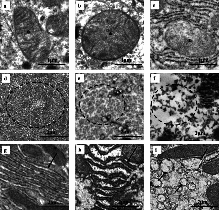Classification of TEM findings by intracellular organelles. Asterisk mitochondria; inside dotted line glycogen granules; arrow rER. As shown below, 0 was defined as normal, 1 as mildly abnormal, and 2 as highly abnormal. TEM findings of liver tissue are summarized in Table 2. a - c TEM of mitochondria. a Clear membrane/normal cristae = score 0, b Round shape/ruptured cristae = score 1, c Autophagosome formation/decrease in number = score 2, d - f TEM of glycogen granules. d Rich = score 0, e Decrease in number = score 1, f Complete loss = score 2, g - i TEM of rER. g Normal = score 0, h Expansion/degeneration = score 1, i Dissolution/spherical shape (loss) = score 2