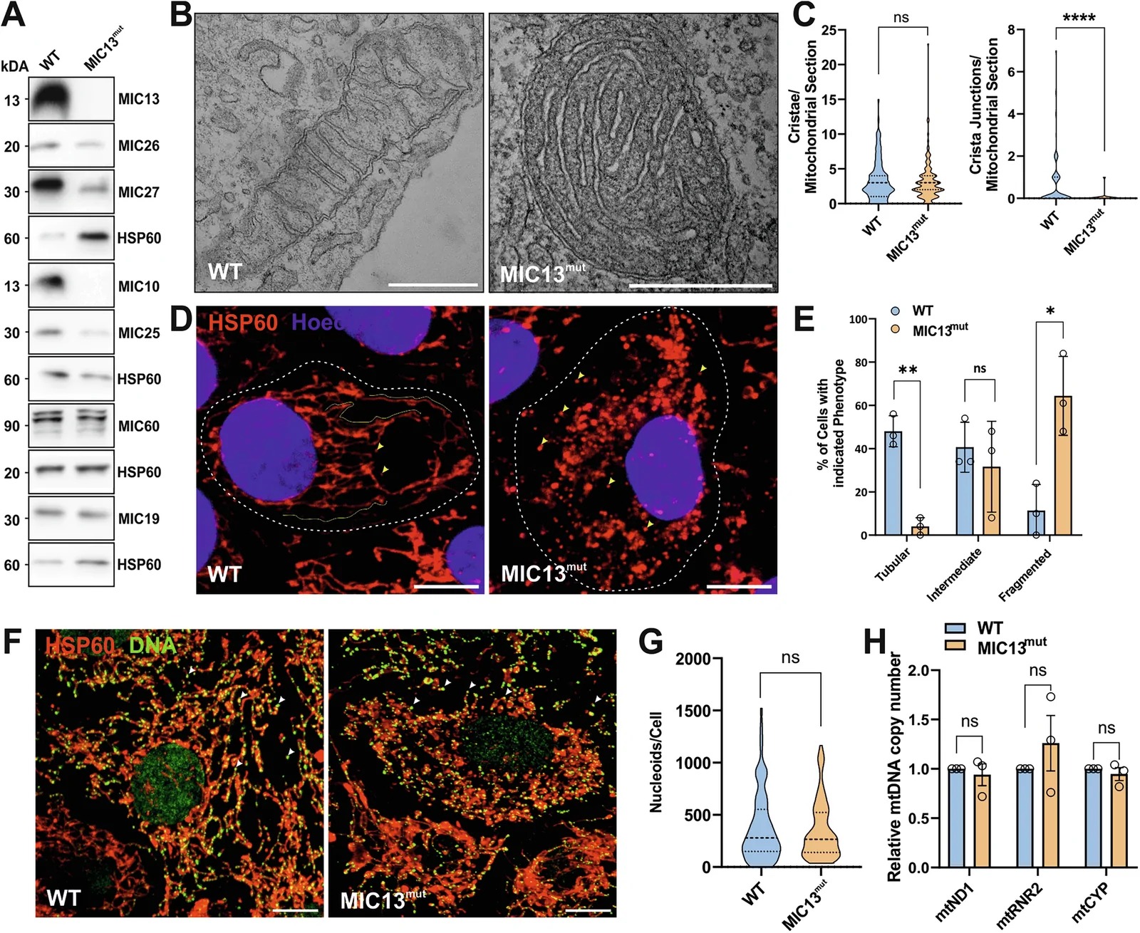 Loss of MIC13 disrupts the MIC10 subcomplex, crista junctions, and mitochondrial network morphology in iHeps. A Western blot analysis shows marked depletion of the MIC10-subcomplex (MIC10, MIC26, MIC27 and MIC13) in MIC13 mut iHeps, while the MIC60-subcomplex (MIC60, MIC19 and MIC25) remains largely unaffected, except for MIC25. B Representative TEM images of WT and MIC13 mut iHeps reveal abnormal cristae ultrastructure, including stacked or ring-like structure of the cristae. Scale bars: 500 nm. C Quantitative analysis of TEM images show that while the number of cristae per mitochondrial sections remains unchanged between WT and MIC13 mut iHeps, there is a significant reduction in number of CJs in MIC13 mut iHeps, indicating impaired cristae organization. Data is shown as separate violin plot with range, median and interquartile values indicated from approximately 135 sections from three independent (n = 3) experiments. D Representative confocal images of WT and MIC13 mut iHeps immunostained for HSP60 (mitochondria, red) and counterstained with Hoechst (nuclei, blue) revealed extensive mitochondrial fragmentation in MIC13 mut iHeps. Yellow arrowhead indicate fragmented mitochondria and yellow lines traces tubular mitochondria. Scale bar: 10 um. E Quantification of mitochondrial network morphology, shown as a bar graph representing the percentage of cells displaying tubular, intermediate or fragmented mitochondria.