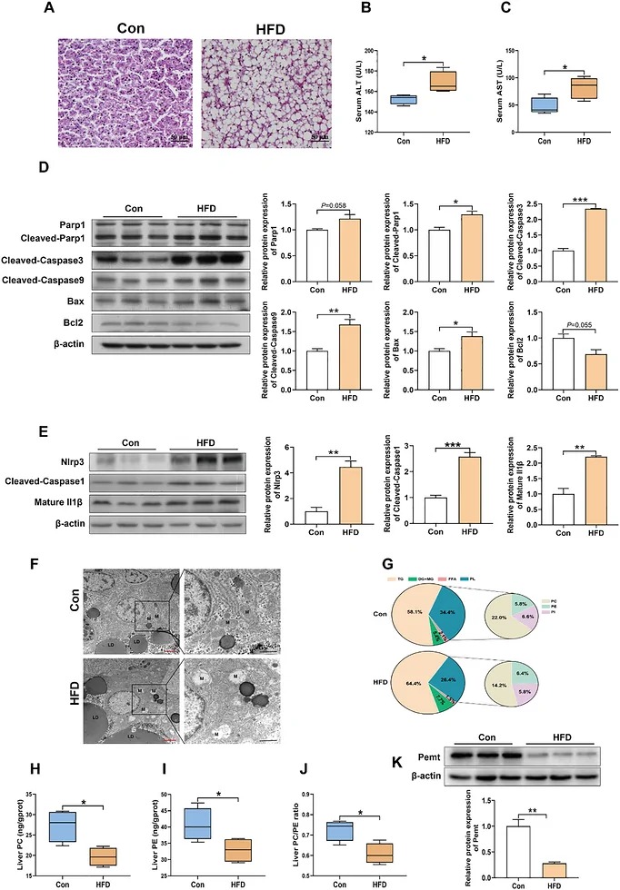 HFD diet induces liver injury and inhibits hepatic Pemt expression in large yellow croaker. (A) HE staining of liver sections in the Con and HFD groups (n = 4). Scale bars, 50 um. (B) Serum alanine aminotransferase (ALT) and (C) aspartate aminotransferase (AST) activities in the Con and HFD groups (n = 6). (D) The protein expression of apoptosis-related protein (Parp1, Cleaved-Parp1, Cleaved-Caspase3, Cleaved-Caspase9, Bax, and Bcl2) (n = 3) and (E) Nlrp3 inflammasome activation-related protein (Nlrp3, Cleaved-Caspase1, and mature Il1beta) in the liver of fish fed Con and HFD diets (n = 3). (F) Mitochondrial structure in the liver identified by TEM in fish fed Con and HFD diets. Red scale bars, 2 um, black scale bars, 1 um. M, mitochondria, LD, lipid droplet, N, nucleus. The results are presented as the mean +/- SEM. * p < 0.05, ** p < 0.01, and *** p < 0.001.
