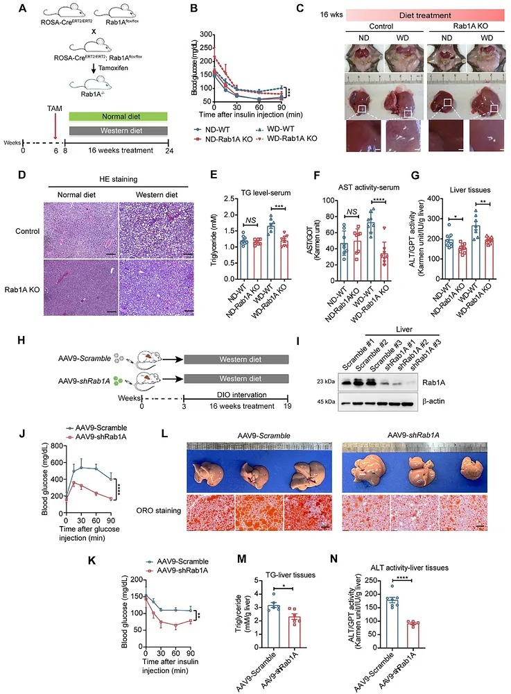 Rab1A deficiency alleviates western diet-induced hepatic steatosis in adult mice. (A) Experimental scheme for establishing WD-induced models with wild-type control (WT) and Rab1A knockout (KO) mice (n = 8). (B) ITT of mice after 16 weeks on the diet. Results are presented as mean +/- SEM (n = 8), *** p < 0.001, analyzed by two-way ANOVA. (C) Representative images of livers in WT and Rab1A KO mice on the diet in situ. White speckles indicate lipid accumulation. Scale bar, 1 mm. (D) Representative H&E staining of liver sections in WT and Rab1A KO mice on the diet. White holes indicate hepatic steatosis. Scale bar, 50 um. (E) Triglyceride levels in serum from 4 groups of mice were quantified using respective kits. Results are presented as mean +/- SEM (n = 8). *** p < 0.001, unpaired Student t-test for two groups. (F) AST from serum of 4 groups of mice was quantified using the respective kits. Results are presented as mean +/- SEM (n = 8). **** p < 0.0001, unpaired Student t-test for two groups. (G) Quantification of ALT in liver supernatants from WT and Rab1A KO mice on diet. Results are presented as mean +/- SEM (n = 8). * p < 0.05, ** p < 0.01, unpaired Student t-test. (H) Experimental design of WD-induced model in Rab1A liver-specific knockdown and control mice (n = 8). (I) Validation of Rab1A knockdown in liver upon AAV-shRab1A delivery by immunoblot. (J,K) GTT and ITT performed with Scramble and Rab1A knockdown mice (16 weeks on diet). Results are presented as mean +/- SEM (n = 7). ** p < 0.01, **** p < 0.0001, analyzed by two-way ANOVA. (L) Representative images of livers and ORO staining of liver sections with Scramble and Rab1A knockdown mice. Scale bar, 100 um. (M) Quantification of triglyceride levels in liver supernatants from Scramble and Rab1A knockdown mice on a diet. Results are presented as mean +/- SEM (n = 6). * p < 0.05, unpaired Student t-test. (N) Quantification of ALT in liver supernatants from Scramble and Rab1A knockdown mice on diet. Results are presented as mean +/- SEM (Scramble = 7, shRab1A = 5). **** p < 0.0001, unpaired Student t-test.