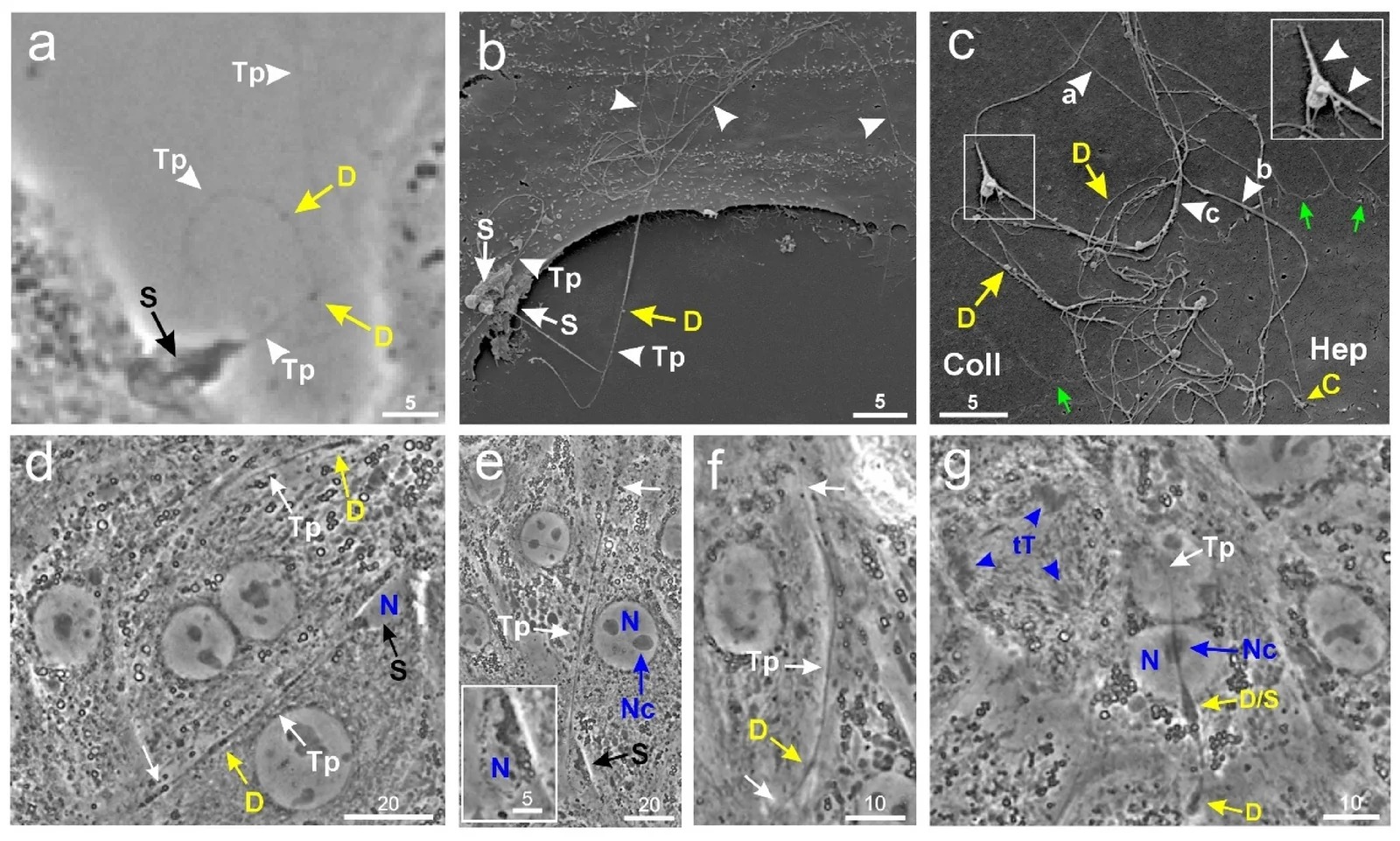 hTCL phenotype in proliferating primary hepatocyte cultures analyzed by LCI and SEM. The cultures were incubated in serum-free MEM supplemented with EGF (40 ng/mL) and insulin (0.9 ug/mL). (a) Phase contrast image of an hTCL locating to a hepatocyte where the soma (S) as well as the telopodium (Tp, white arrows; diameter of about 500 nm) with dilations (D; podomes) can be resolved. It is not clear whether the dark zone at the soma-Tp connection (S, black arrow) represents the nucleus (23 h 30 min after culture). (b,c) SEM inspection of hTCLs after 24 h of incubation; (b) two hTCLs locating to a hepatocyte membrane can be seen, one hTCL showing a very long Tp (white arrows) with several dilations (D). (c) Array of telopodia (white arrows) extending at a hepatocyte border (Hep; green arrows) to the collagen coat (Coll) also showing several dilations (D), Tp end-contacts to the cell surface (C), and distinct Tp-to-Tp contacts (insert). Annotated are two telopodia with diameters of 150 nm (a) and 286 nm (b) and a Tp-bundle of 430 nm diameter (c).