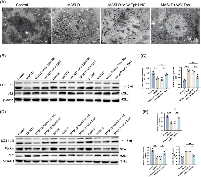 Knockdown of Tph1 activates Parkin-mediated mitophagy and alleviates hepatic injury in MASLD mice. (A) TEM images showing mitochondrial ultrastructure in liver tissue. Scale bar = 5 um (B, C) Western blotting analysis and quantification of LC3 and p62 expression in total liver lysates ( n = 3 per group). (D, E) Western blotting analysis and quantification of LC3, Parkin, and p62 protein levels in mitochondrial fractions ( n = 3 per group). Data are presented as mean +/- SD. * P < 0.05; ** P < 0.01; *** P < 0.001. TEM, transmission electron microscopy; MASLD, metabolic dysfunction-associated steatotic liver disease; AAV, adeno-associated virus; NC, negative control.