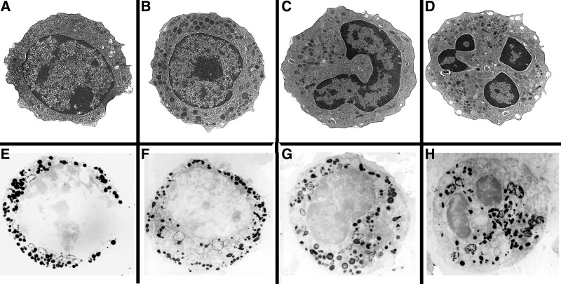 Normal neutrophils in (A)-(D), showing developmental stages of myeloblasts: myeloblasts (A), promyelocytes (B), myelocytes (C) to segmented granulocytes (D), x5k. (E)-(H) Positive myeloperoxidase reactivity of primary granules, x5k.