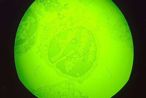 Macrophage cell in early stages of infection with African swine fever virus, magnified about 1,000x.