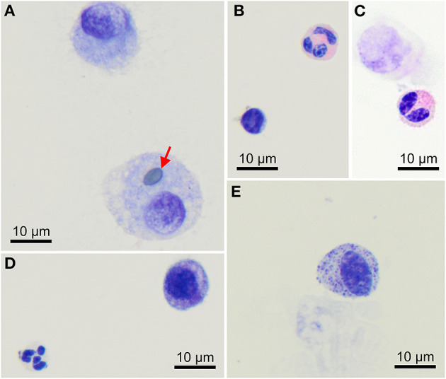Morphology of cells found in bronchoalveolar lavage samples from healthy cynomolgus macaques. (A) Macrophages, one of them contains a pollen grain (arrow). (B) One lymphocyte (bottom left) and one eosinophil (upper right). (C) Bilobed eosinophil (bottom). (D) One well-preserved neutrophil (bottom left) and a macrophage (upper right). (E) Mast cell. Modified Giemsa. X100 objective. Oil immersion.