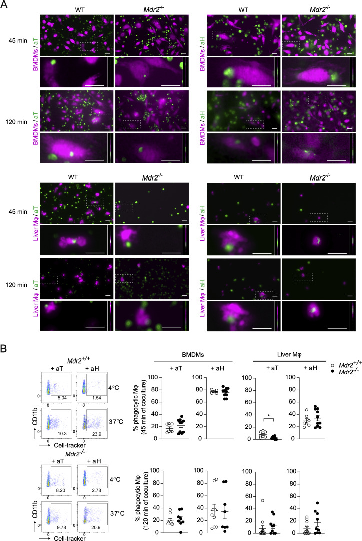 Efferocytic capacity of bone marrow-derived and hepatic Mf from Mdr2-/- mice. (A and B) (A) Representative images, and (B) FACS plots from liver Mf and graphs reporting the frequency of Mdr2+/+ and Mdr2-/- Mf differentiated from the bone marrow (BMDMs) or isolated from the liver (liver Mf), engulfing in vitro apoptotic thymocytes (aT) or apoptotic hepatocytes (aH) upon 45 min or 120 min coculture. Efferocytic Mf are identified as CD11b+ F4/80