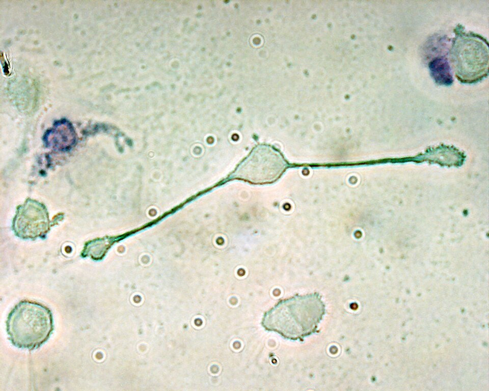 A macrophage of a mouse forming two processes to phagocytize two smaller particles, possibly pathogens.