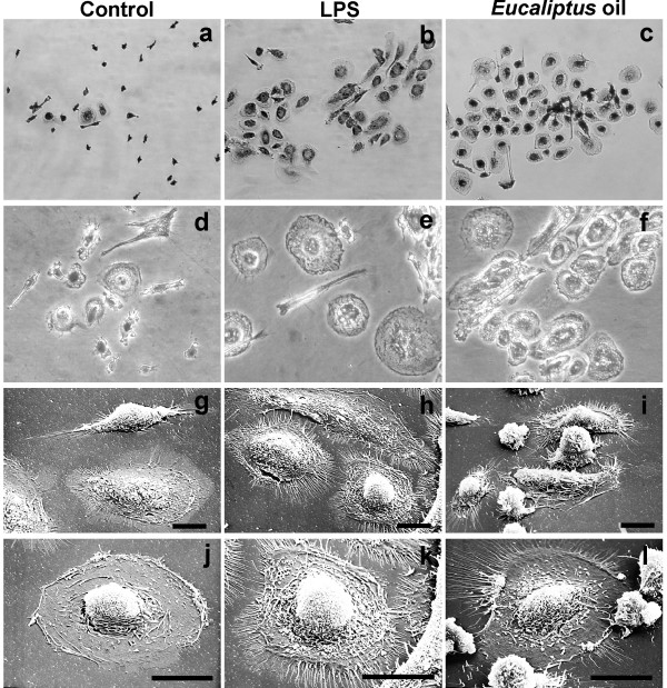 Morphological features of human MDMs after 24 h of in vitro treatment with Eucalyptus oil. a-f, phase-contrast microscopy after Wright Giemsa staining: a, d, untreated control; b, e, MDMs stimulated with 0.1 μg/ml of bacterial lipopolysaccharide (LPS); c, f, MDMs treated with 0.016% Eucalyptus oil; a, b, c, original magnification: 20×;d, e, f, original magnification: 40×. g-l, Scanning electron microscopy of untreated (g, j), LPS treated (h, k) and Eucalyptus oil treated MDMs (i, l). Bars: 20 μm.