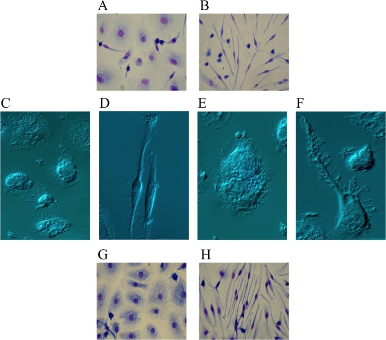Ibrutinib-induced differentiation into fibrocyte-like cells Purified human monocytes were cultured in the presence of 100 ng/mL M-CSF. (A–F) Monocytes were cultured in serum-containing medium in the absence (A, C, E) or presence (B, D, F) of 10 μM Ibrutinib. After 10 days, cells were air-dried, fixed and stained with May-Grunwald and Giemsa solutions for optic microscopy (A, B) or captured unstained for interference microscopy (C–F). Monocytes cultured with only M-CSF (A, C, E) displayed a fried-egg or slightly spindle shape with round nuclei, typical of M-CSF-differentiated cells. Monocytes treated with Ibrutinib (B, D, F) displayed a fibrocyte-like morphology with an elongated shape.