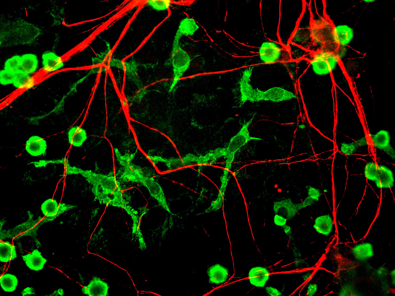 Mixed rat brain cultures stained for coronin 1a, found in microglia here in green, and alpha-internexin, in red, found in neuronal processes.