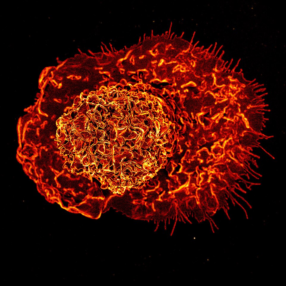 Scanning electron micrograph of a macrophage, colorized in Halloween colors. Stay safe and have a Happy Halloween! Credit: NIAID